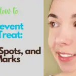 Clear, Radiant Skin: Tackling Acne, Spots, and Marks